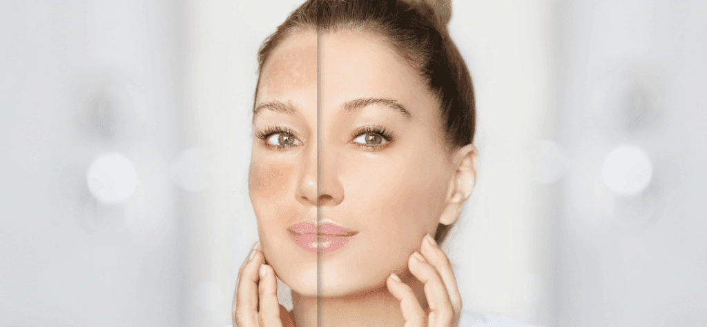 Winter Skin 101
