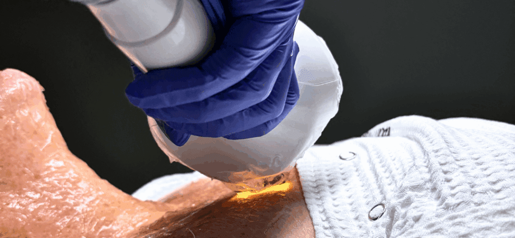 IPL Photofacial: The Best Time to Treat Sun Damage Is Now
